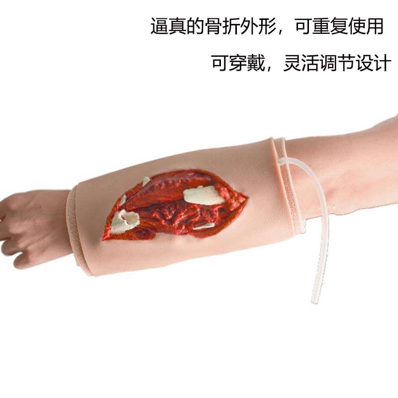 穿戴式二级开放性骨折模型