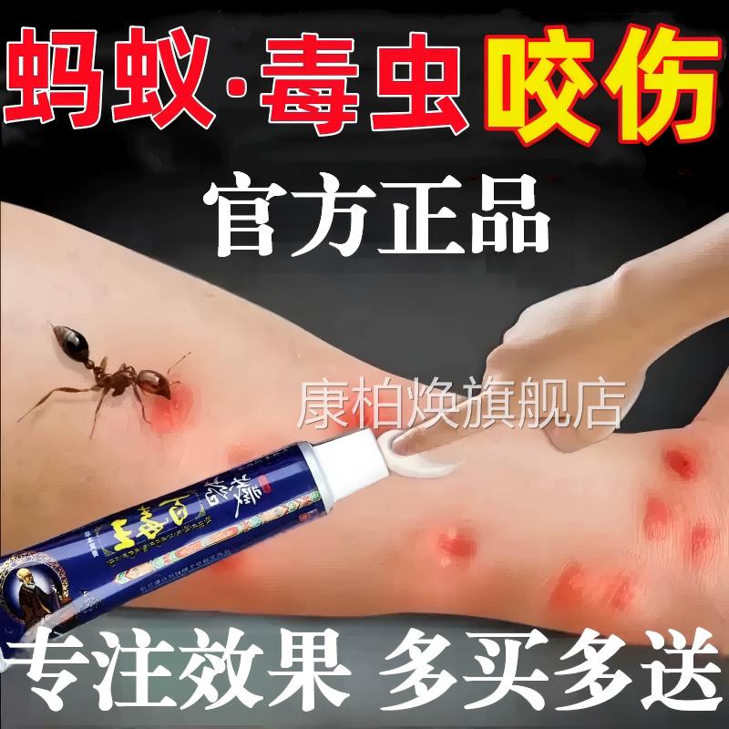 蚂蚁消毒虫咬伤膏蚊虫叮咬隐翅虫跳蚤螨虫叮咬肿外用抑止痒膏正品