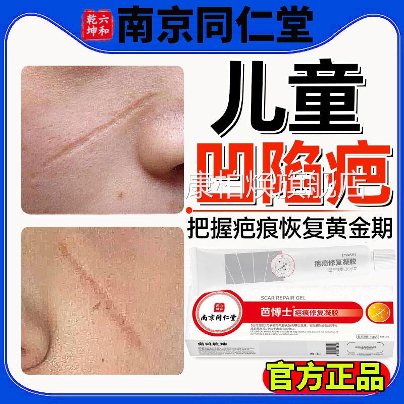 儿童擦伤摔伤凹陷性疤痕复手术修抓伤除疤膏去黑色素沉旗舰店L康
