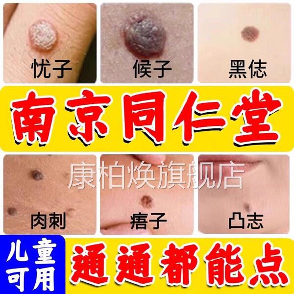 点志膏痕去无非药水祛去黑脸部美容不留疤官方正品旗舰店nn康柏焕