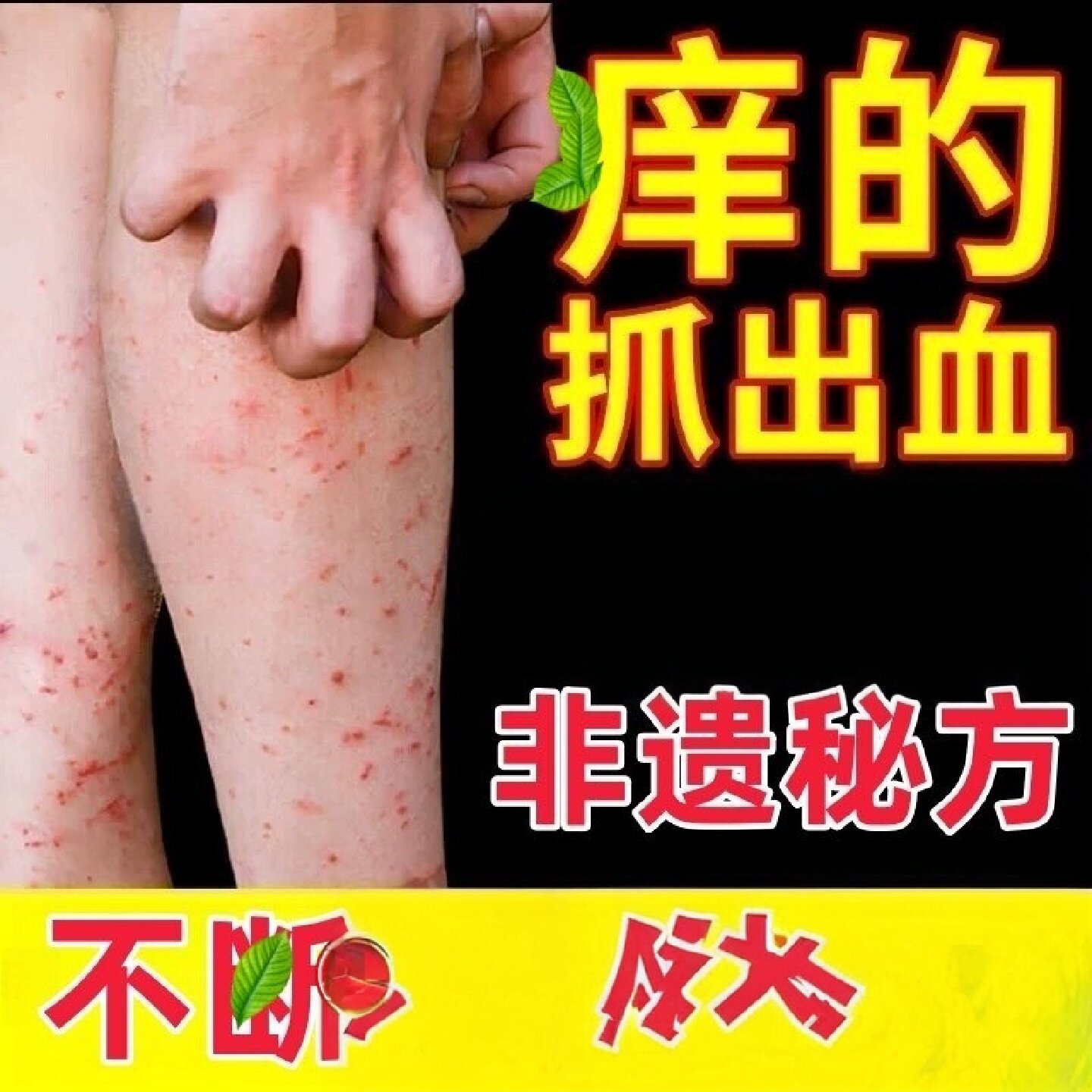 皮肤干瘙燥痒老年人湿疹止痒去外根用顽固皮炎腿皮肤干燥止抑旗舰