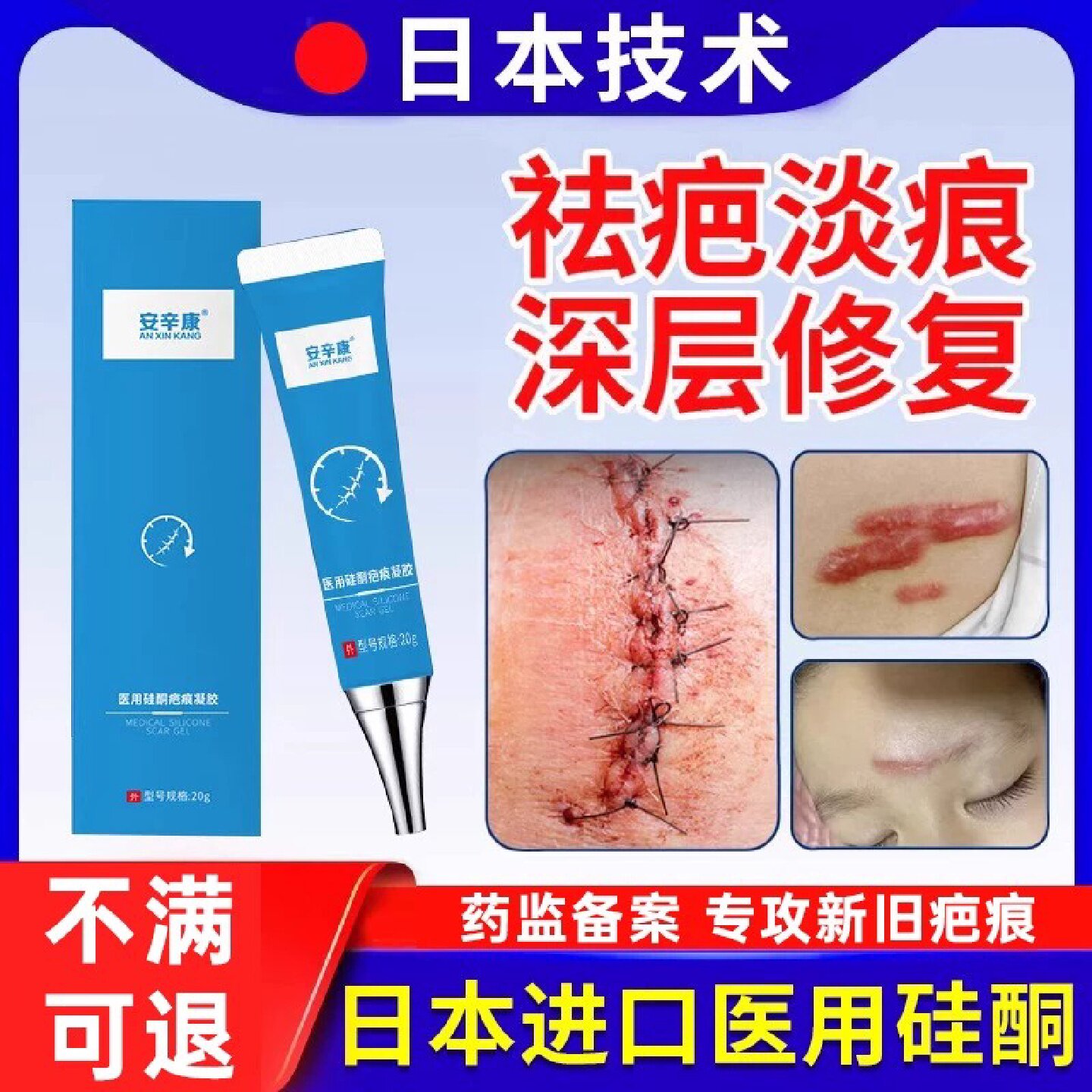 日本祛疤膏去疤痕修复除疤膏医用硅酮凝胶剖腹产烫伤增生凸起旗舰