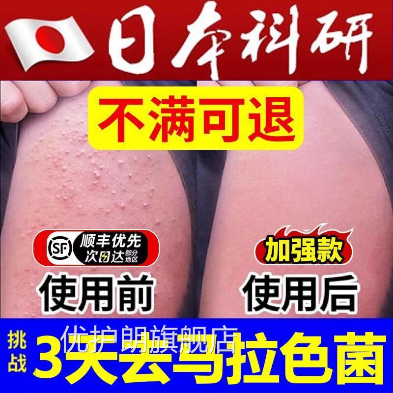 手臂毛马拉色菌专用长痘胳膊上脂溢性小疙贴真痘菌鸡皮肤角化感染