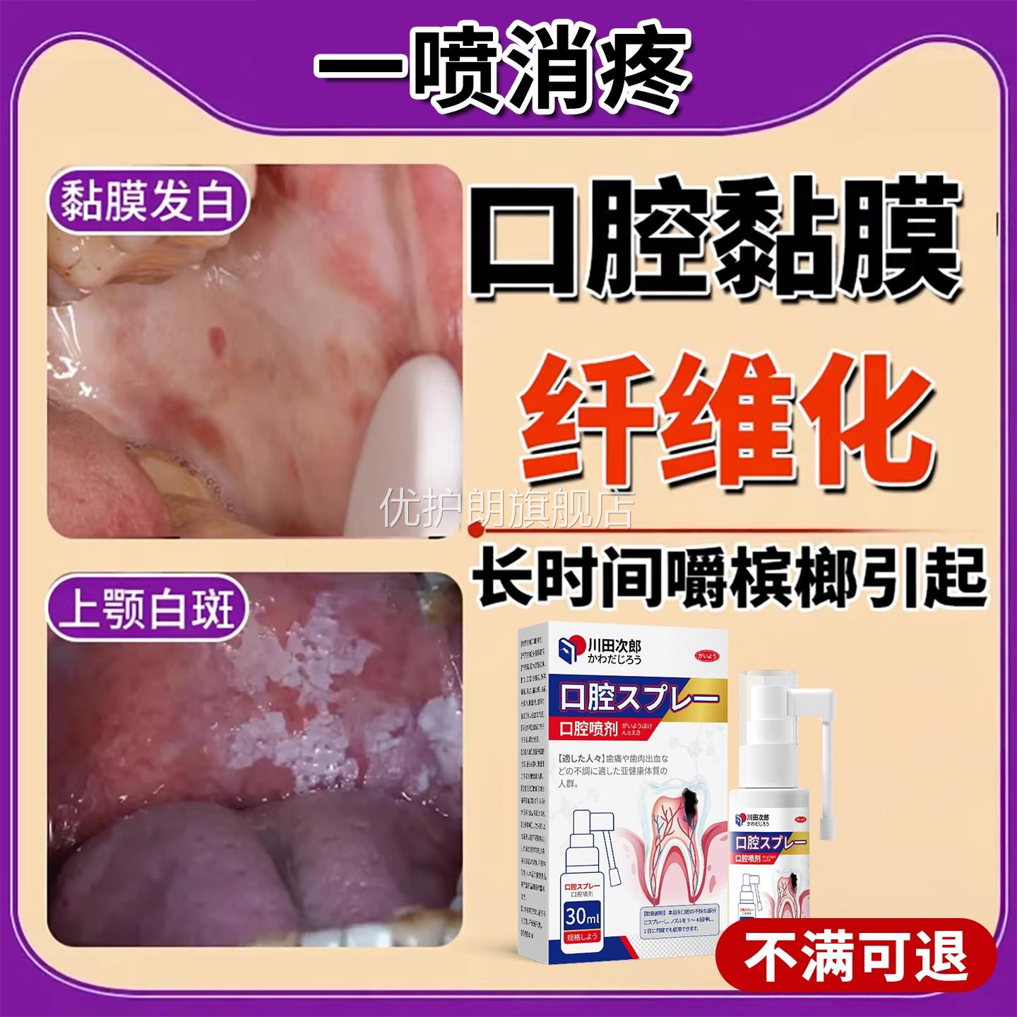 嚼槟榔口腔黏膜纤维化专用溃疡白斑黏膜红肿修复喷剂口腔扁平苔藓