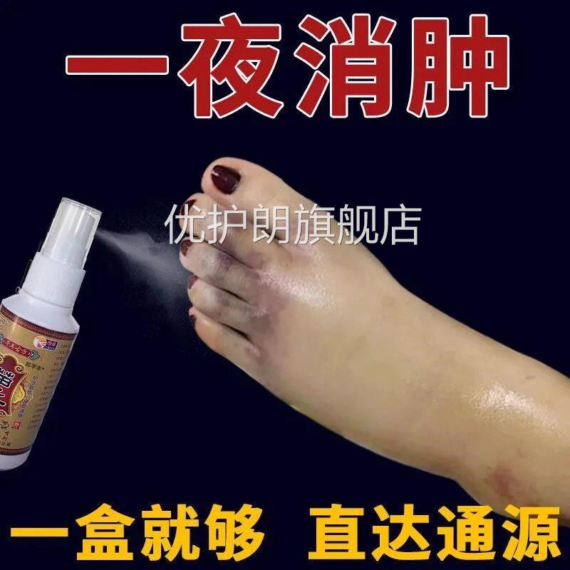 去水肿消特效的药老人脚肿消肿的药消肿止痛喷剂血化活瘀外用专用