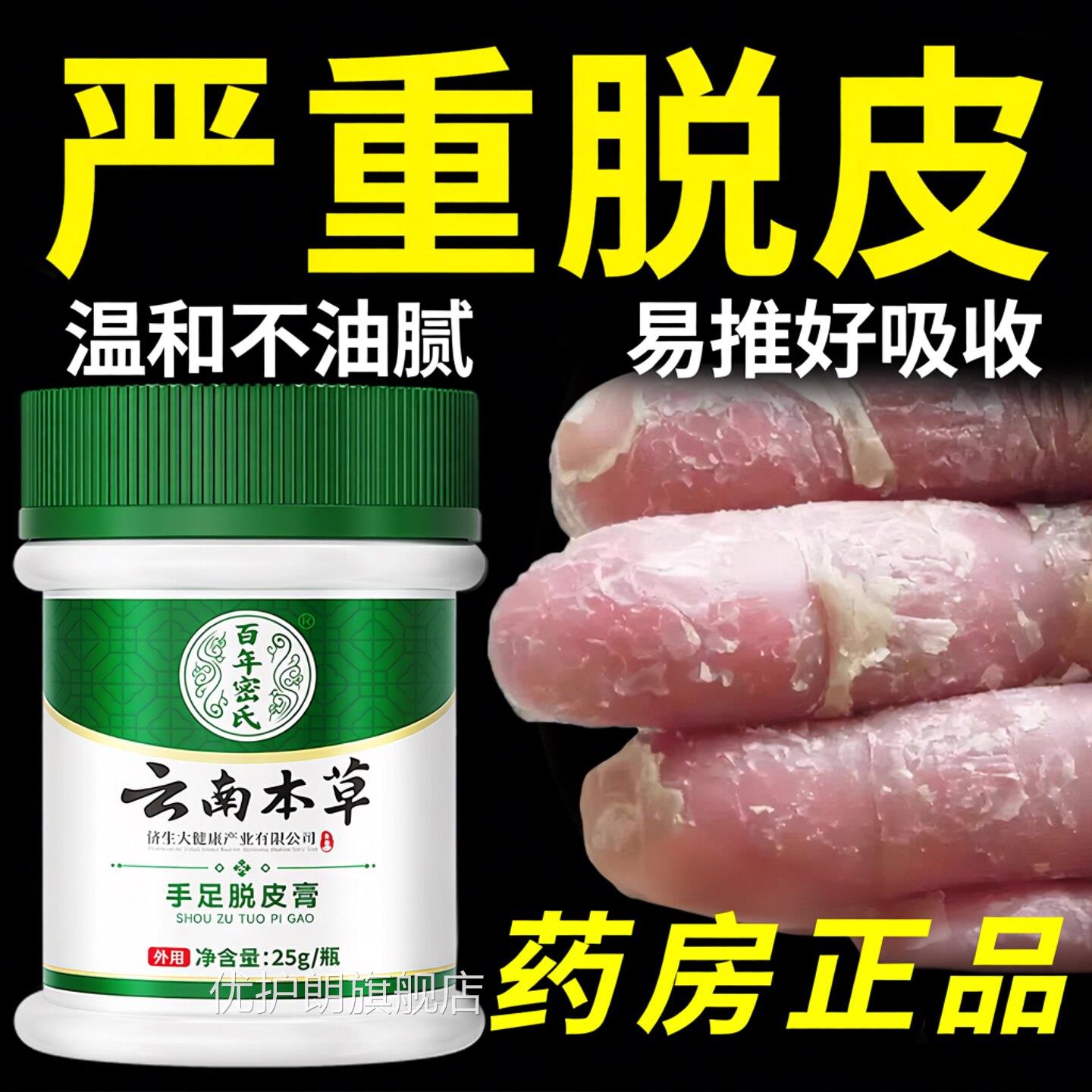 手足脱皮燥膏手指头裂口子脱皮开裂抑菌膏起皮干手掌蜕皮掉皮专用