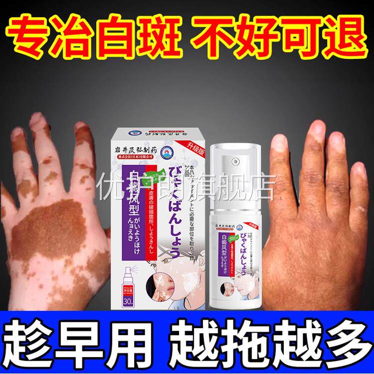 皮肤汗斑白斑净喷剂外用白癜黑色素补骨脂酊风生长专用抑菌液正品