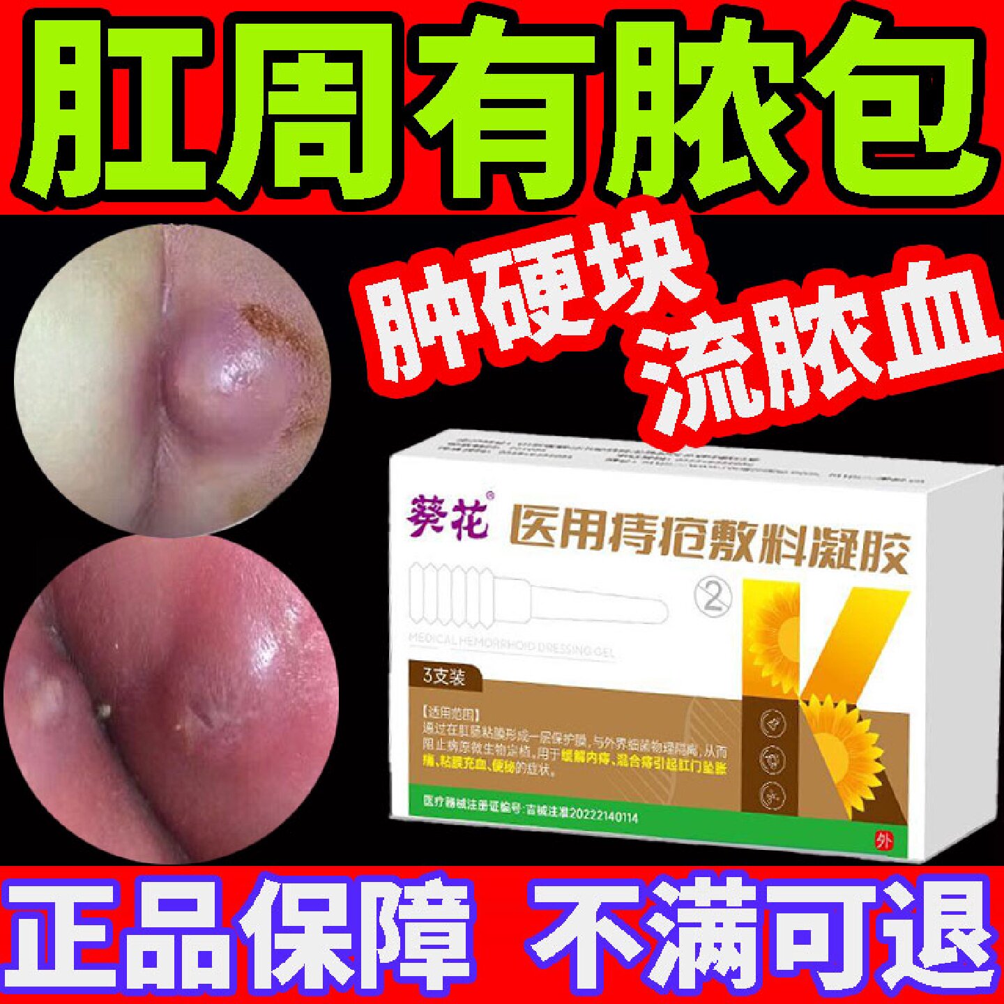 肛瘘内克口星肛裂愈肛周脓肿合膏大便出血肛门撕裂特封口效药旗舰