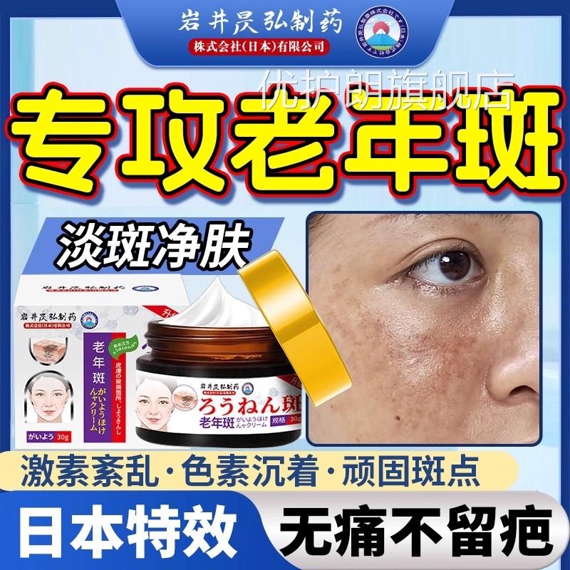 去老人斑专用膏除黑强力去除中药手部老年斑净老人斑一抹擦祛就掉