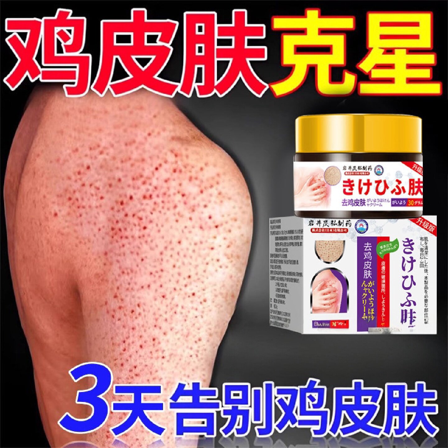 日本去鸡皮肤鱼鳞疙瘩毛囊角化症角质膏用手臂身体去除旗舰店