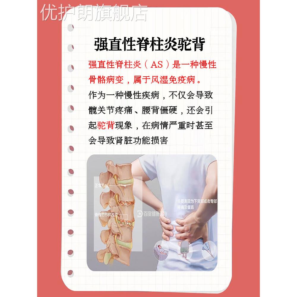 强直性脊柱炎专用贴膏强制性脊柱炎生物制剂医疗器械矫正驼背HM优