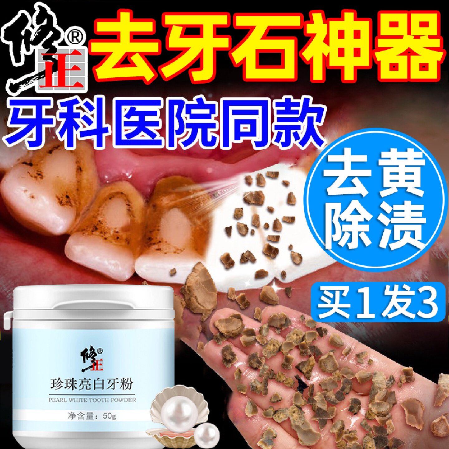 牙结石去除器洗牙齿污垢除牙石速效溶解黄牙美白去黄牙刷清洁旗舰