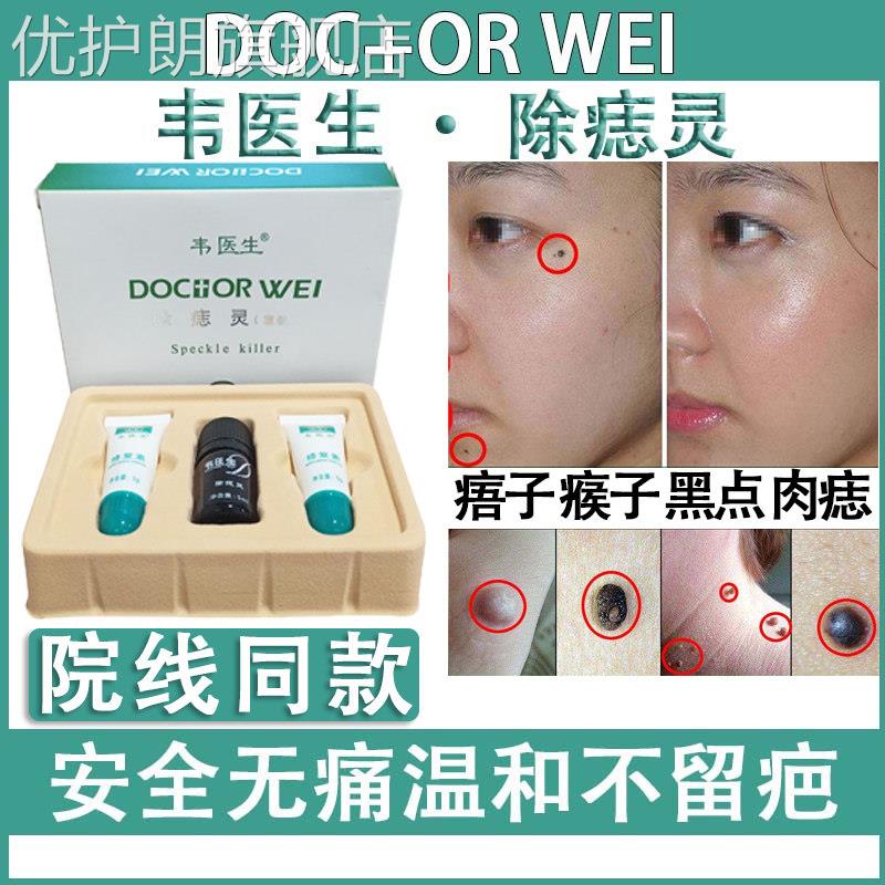 点痣膏无痕正品点痣神器点痣水雀斑专用去痣膏脸部韦医生除痣灵优