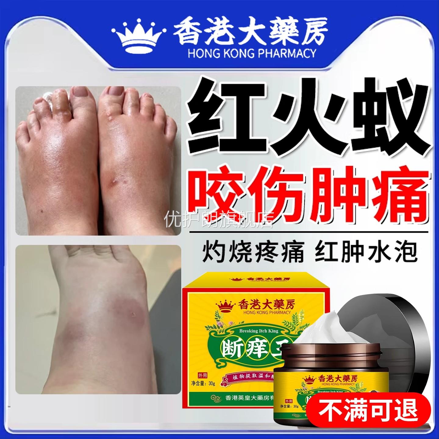 红火蚁蚂蚁咬伤膏克蚊虫叮咬隐翅虫毒虫跳蚤螨虫叮咬痒止消肿外用
