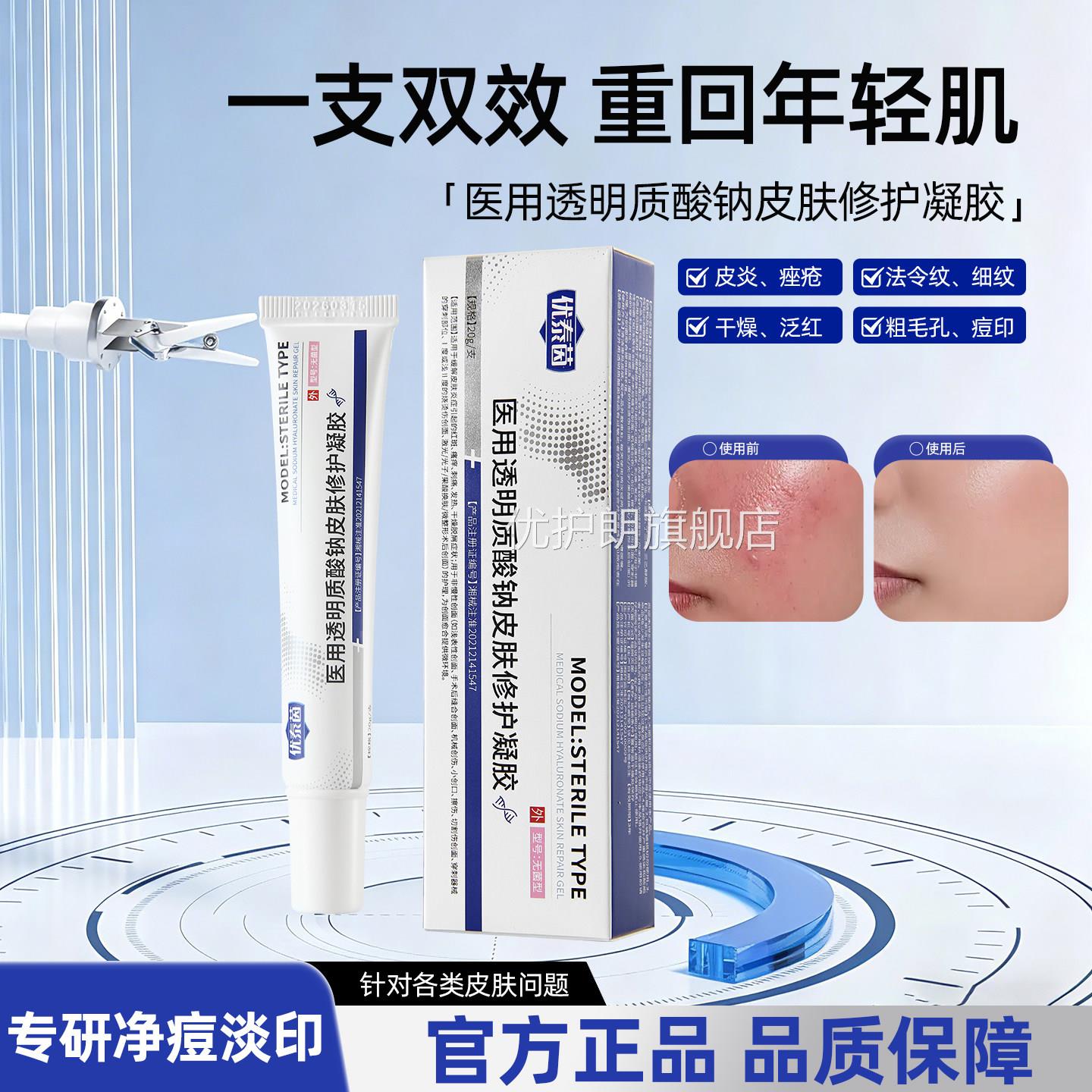 ytay小白管优泰茵去痘印毛孔痤透明疮质酸钠痘痘医用修护凝胶9tl