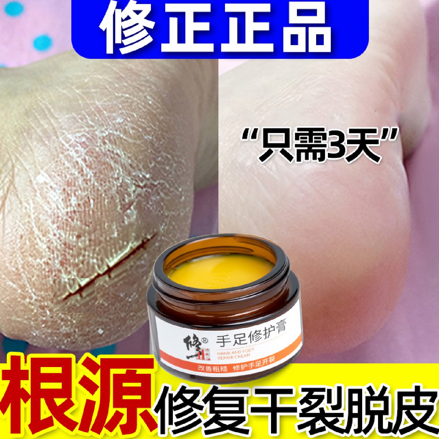 治脚后跟干裂修复霜手足脚裂马油口龟裂防脚跟开裂脱皮起旗舰店
