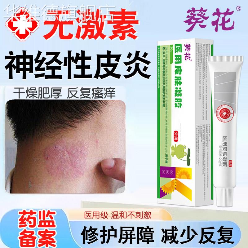 神经性皮炎药监备案无激素治去喷剂止痒根疗除敷料眼皮脖子外用膏