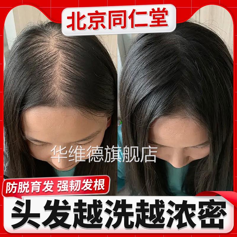 北京同仁堂生姜防脱洗去发水生发中药增发密发屑育发排行榜名华维