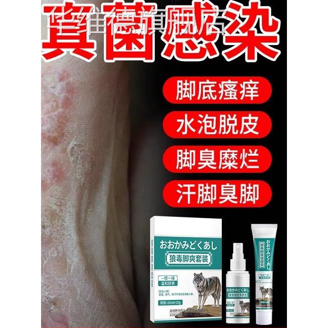 狼毒治脚气喷剂雾臭烂脚丫药脱皮糜烂脚趾缝止痒杀菌膏官方旗舰店