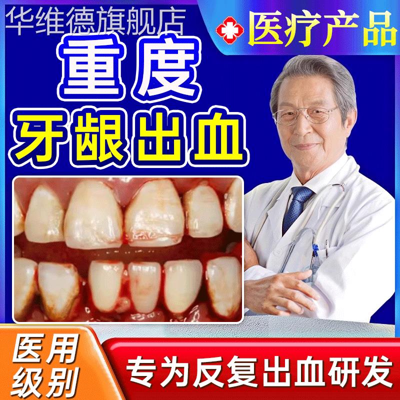 云南白药牙膏牙周炎牙龈出血专用双效抗敏牙龈脓包肿痛消炎药膏gx
