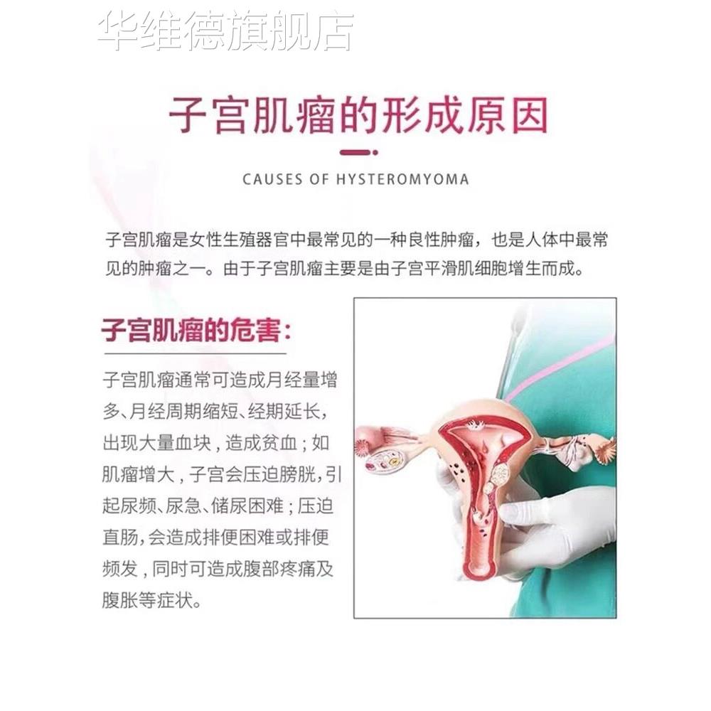 子宫肌瘤泡脚包中药贴卵巢囊肿消茶宫瘤清自己治热敷女性调理疗LL
