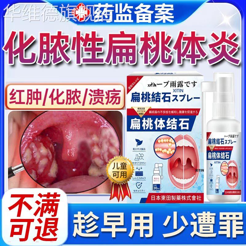 急性化脓性扁桃体炎专用喷雾剂喉咙肿痛扁桃体炎用的嗓子疼红肿PP