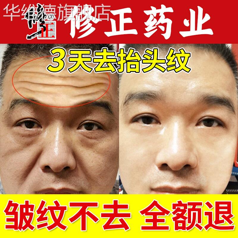 面霜保湿搭擡头纹祛去除男士消除皱纹神器抗皱提拉紧致额头抗衰老