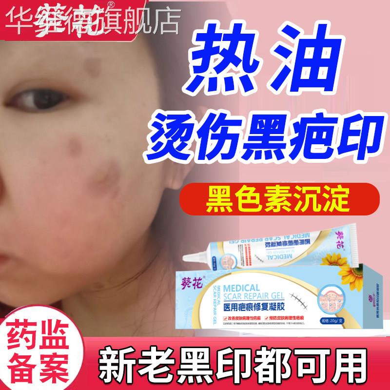 开水热油烫伤去黑印色素沉淀疤痕修复除疤膏祛脸部溅伤淡化黑疤印