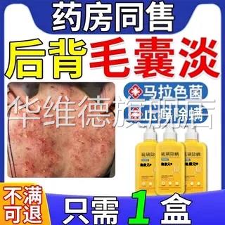 治后背长痘痘毛囊疗炎专用二硫化硒洗剂药膏马拉色菌特沐浴露效FF