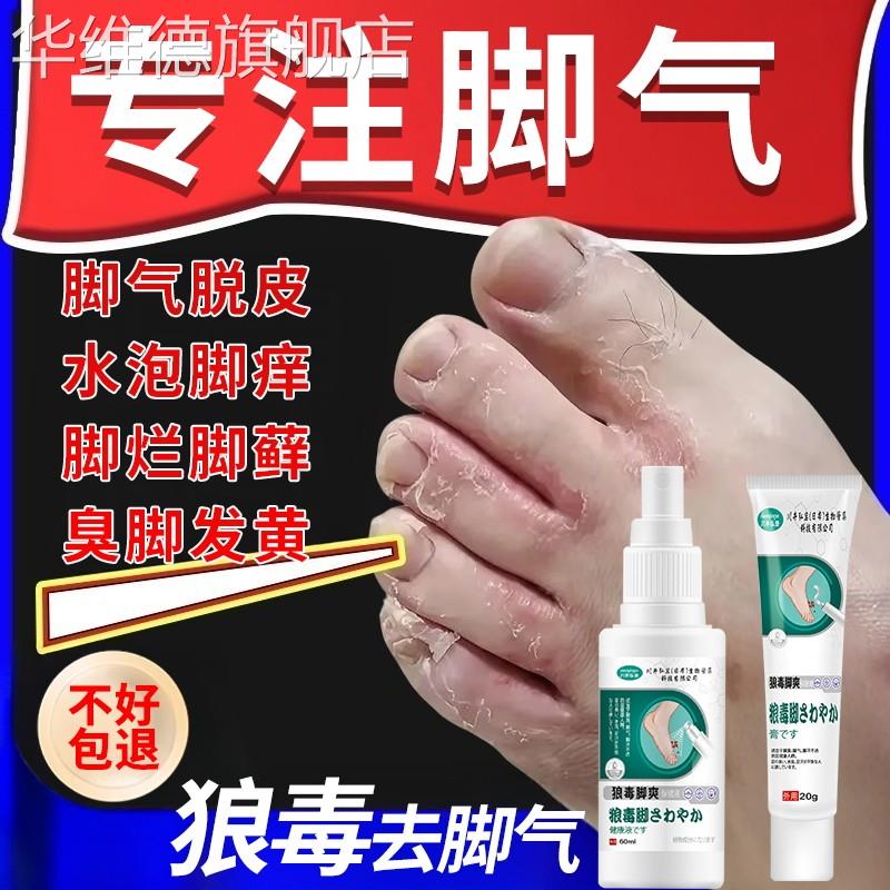 脚气去烂脚丫根脱皮糜烂脚趾脚气止痒脱皮杀菌真菌感染专用汗臭脚