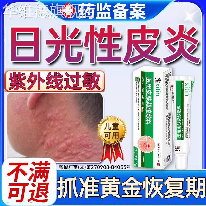 日光性皮炎特效紫外线过敏修复霜专用膏医太阳晒伤皮肤发痒神经PP