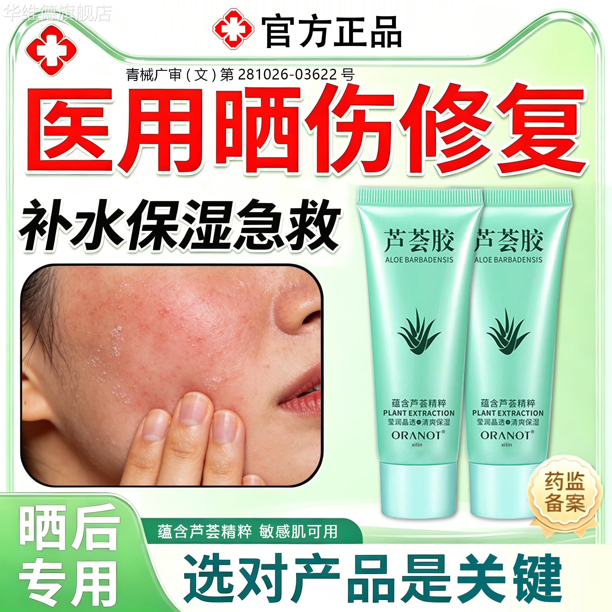 芦荟胶晒后修复皮肤晒伤儿童晒后修复霜过敏止痒专用紫外线过敏FY