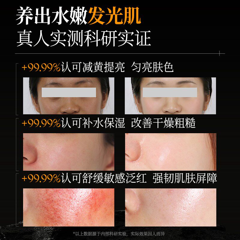OHBT澳白黄芪爽肤水控油祛痘美白去黄提亮肤色补水保湿敏感肌专用