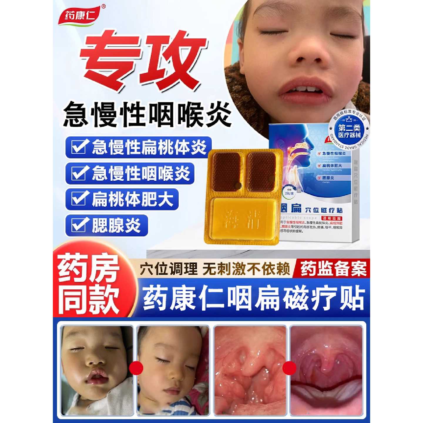 药康仁腺样体贴咽扁贴穴位磁疗贴儿童急慢性咽喉炎肥大腮腺炎旗舰