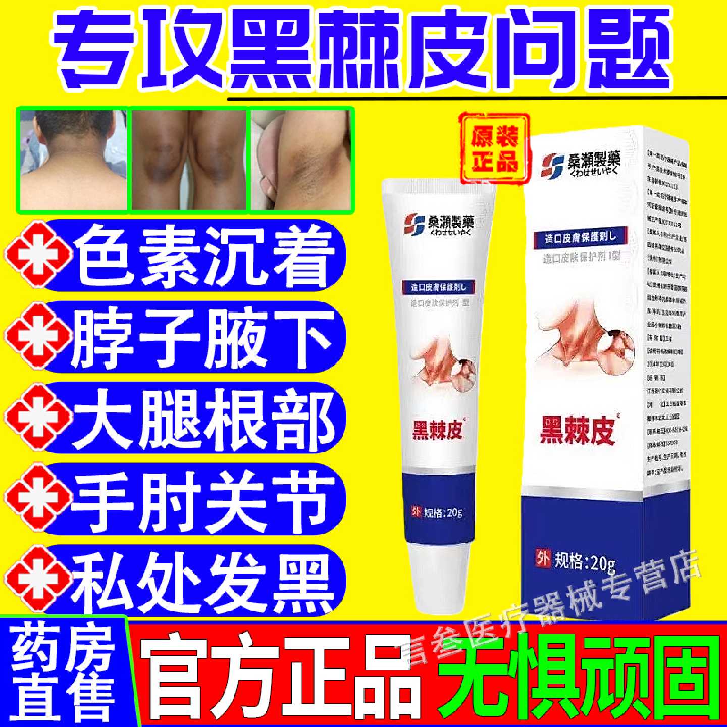疚㡱纲医药黑棘皮症黑色素儿童成人脖子黑大腿根黑手肘黑色素旗舰