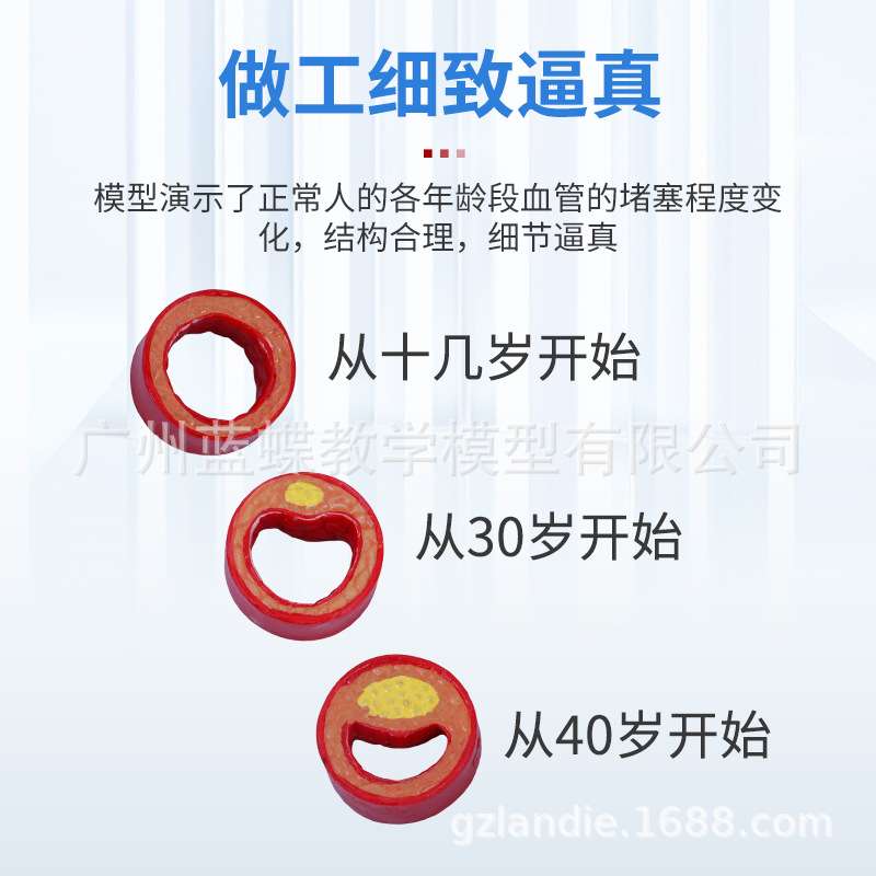 仿真人体冠状动脉性心血管动脉模型硬化模型老年心脏模型血栓模型