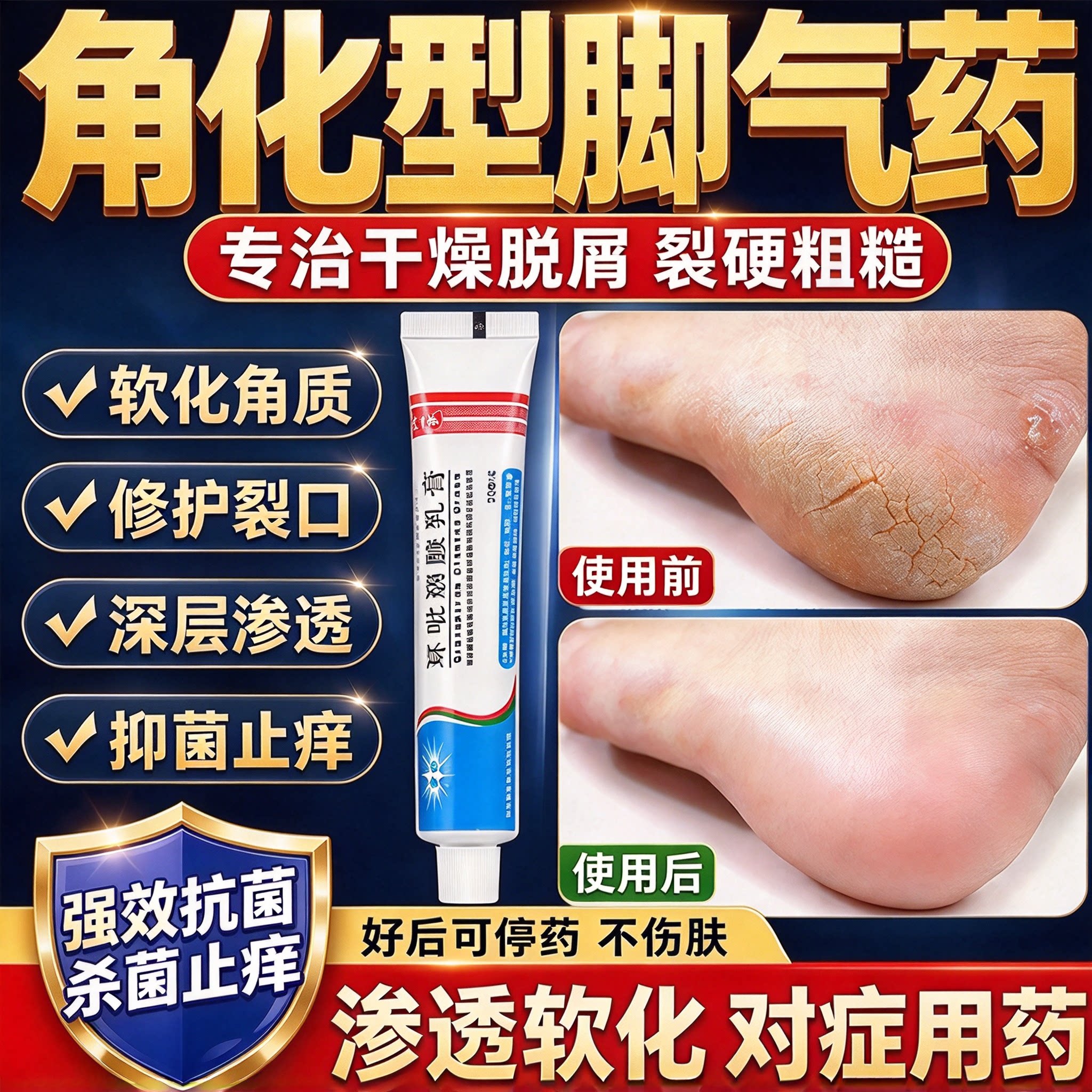 环吡酮胺乳膏官方旗舰店角化型脚气药脚后跟干裂起硬皮足跟开裂药