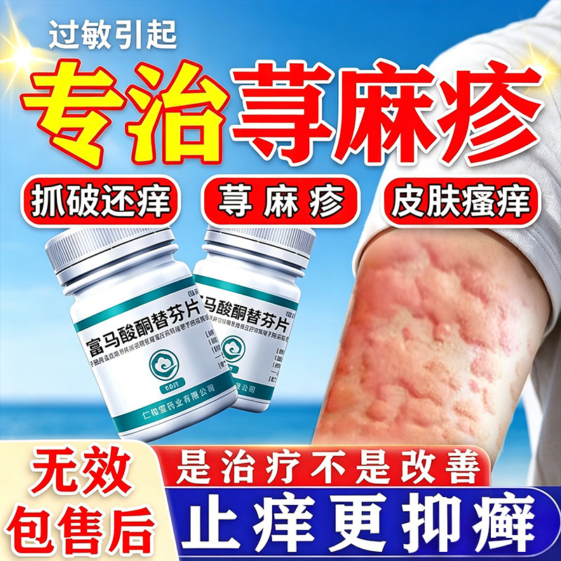 富马酸酮替芬片寻荨麻疹过敏止痒断痒根专用治疗荨麻疹的特痒效药