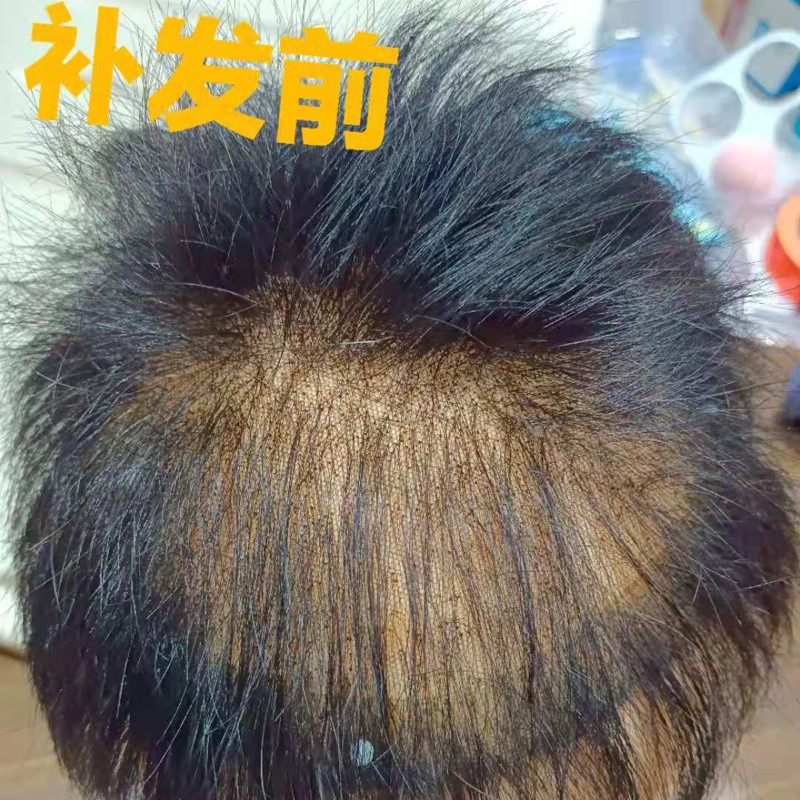 男士假发修补发片 假发掉发可补 修剪 护色 护理 定制