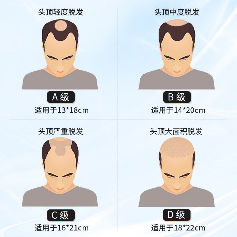 假发男士双递针头顶补发片自然发际线无痕隐形全真发秃顶补发块