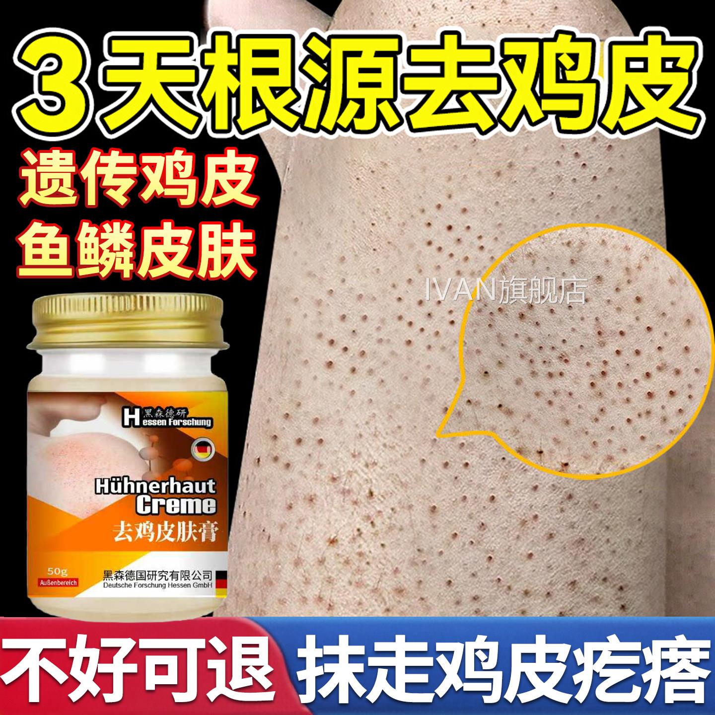 本鸡皮肤疙瘩毛日囊角化症专用膏去除全身手臂胳膊腿干燥起皮神器
