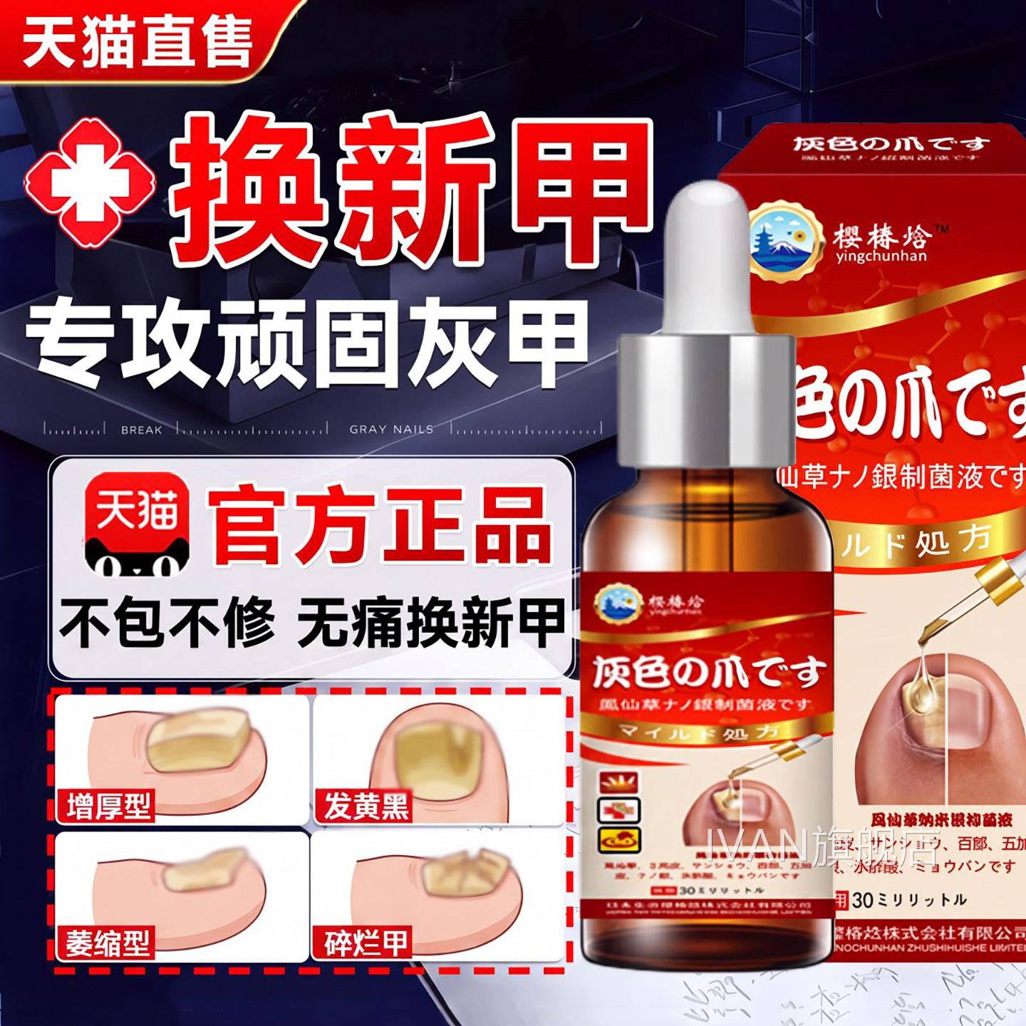 灰指甲凤仙花用药治疗灰指甲非日本进口脱专抑菌官方甲旗舰店正品