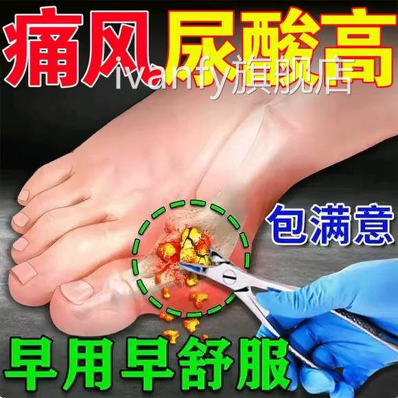 痛风降尿酸溶石脚去结晶消肿止痛膏药贴趾关节红肿胀专消医用炎iv
