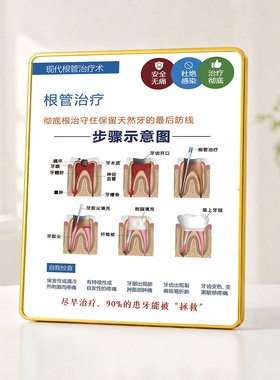 牙科诊所根管治疗流程科普摆件