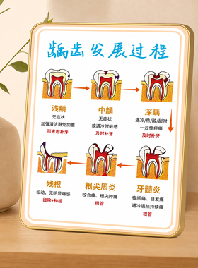 龋齿发展过程科普摆件牙科口腔门诊诊室装饰宣传展示摆台