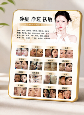 问题肌肤项目净痘净斑祛敏对比展示美容院专用装饰摆件摆台