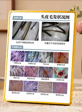 头皮毛发状况图摆台养发馆理发店头皮护理参考展示装饰摆件