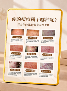 美容院痘痘类型科普摆台皮肤管理祛痘知识宣传装饰摆件