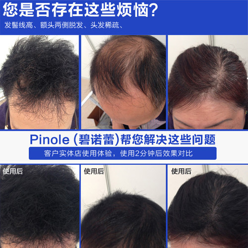 密地增发纤维粉 Toppik 顶丰植物发际线密发美发多密发便携式假发