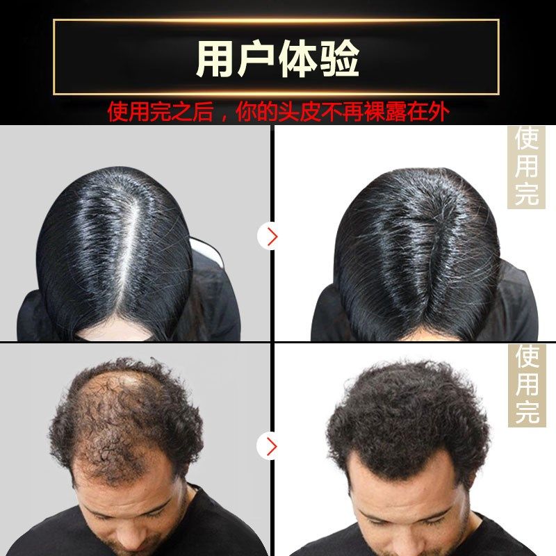 FPLUMP增发纤维粉男女密发假发补发遮盖发粉浓密发根遮瑕头顶丰发